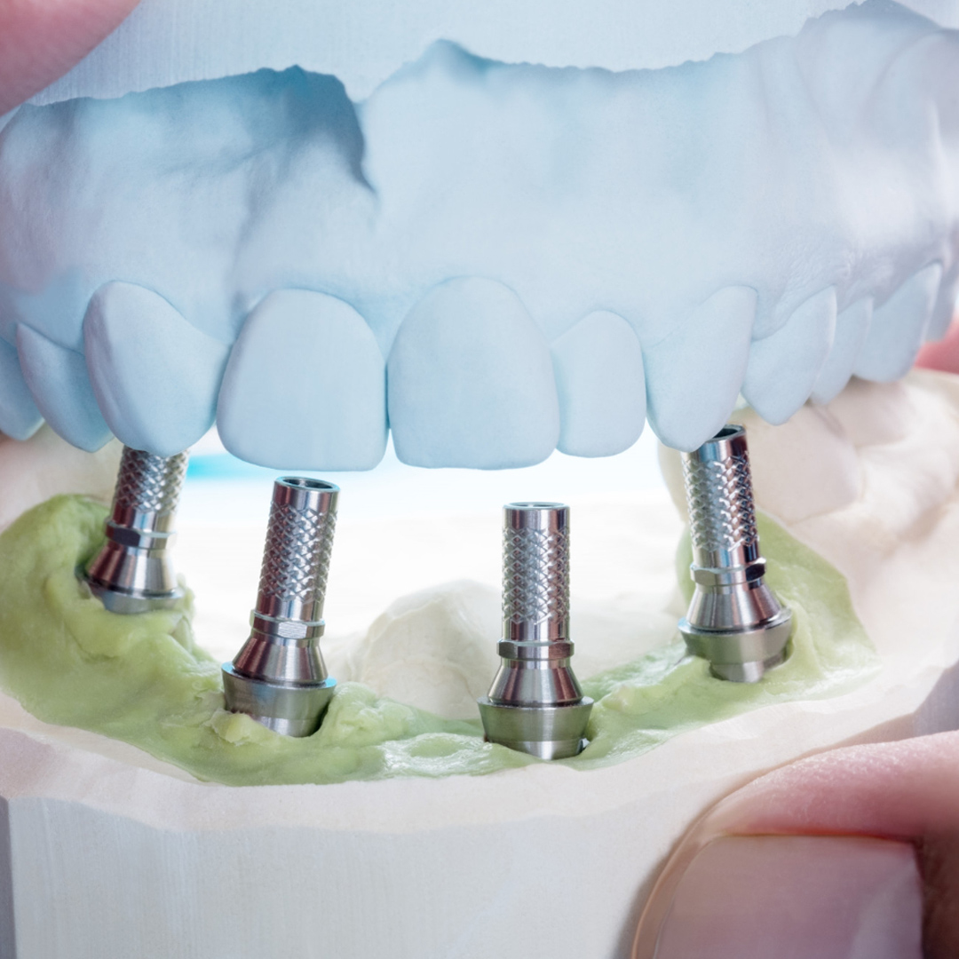 Dental Checkup